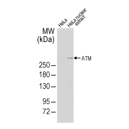 ATM antibody [2C1] (GTX70103)